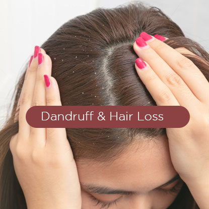 Dandruff-hair-loss-treatment1